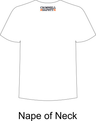 Back Nape